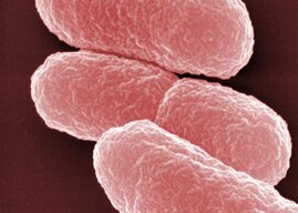 Elektronenmikroskopische Aufnahme von Escherichia coli  