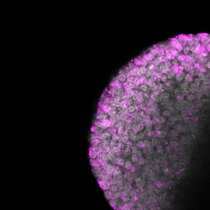 Methyltransferase Dnmt1