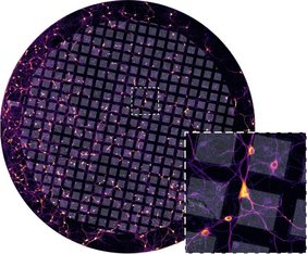 Primäre Hippocampusneuronen der Ratte, die für die kryogene Elektronentomographie auf einem elektronenmikroskopischen Stützgitter kultiviert wurden.
