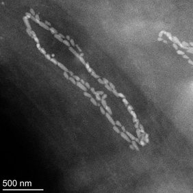Perlschnurförmige Magnetosomenketten des endosymbiontischen Bakteriums. Perlschnurförmige Magnetosomenketten des endosymbiontischen Bakteriums.