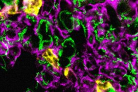 Immunfluoreszenzmikroskopische Aufnahme von Leukozyten (in gelb), die in die Lunge einwandern. Die Lungengefäße sind in magenta angefärbt und die Alveolen in grün. Immunfluoreszenzmikroskopische Aufnahme von Leukozyten (in gelb), die in die Lunge einwandern. Die Lungengefäße sind in magenta angefärbt und die Alveolen in grün.