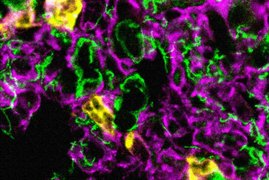 Immunfluoreszenzmikroskopische Aufnahme von Leukozyten (in gelb), die in die Lunge einwandern. Die Lungengefäße sind in magenta angefärbt und die Alveolen in grün. Immunfluoreszenzmikroskopische Aufnahme von Leukozyten (in gelb), die in die Lunge einwandern. Die Lungengefäße sind in magenta angefärbt und die Alveolen in grün.