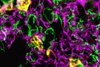 Immunfluoreszenzmikroskopische Aufnahme von Leukozyten (in gelb), die in die Lunge einwandern. Die Lungengefäße sind in magenta angefärbt und die Alveolen in grün.  