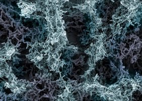 Der Krankheitserreger Pseudomonas aeruginosa bildet einen schützenden Biofilm.  