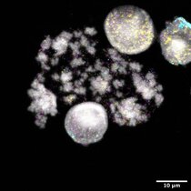 DNA-Ringe Krebsgene