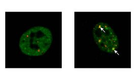 Die fluoreszenzmikroskopischen Aufnahmen zeigen Kerne kultivierter menschlicher Zellen