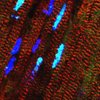 Das Bild zeigt Herzmuskelzellen, in denen das RBM20-Protein hellblau leuchtet