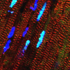Das Bild zeigt Herzmuskelzellen, in denen das RBM20-Protein hellblau leuchtet. Das Bild zeigt Herzmuskelzellen, in denen das RBM20-Protein hellblau leuchtet
