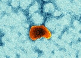 Impfvirus und Transportmittel in einem: Das Masernimpfvirus als Vektorimpfstoff