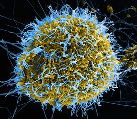 Rasterelektronenmikroskopische Aufnahme von Ebolaviren (blau gefärbt) in einer befallenen Zelle. 