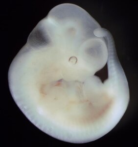 Maus-Embryo. Durch lokale Interaktionen einzelner Zellen bildet ein Embryo Muster verschiedener Zelltypen und Organe. 