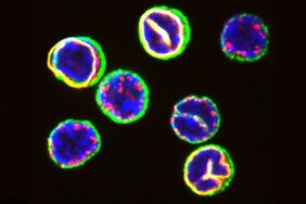 Frisch isolierte T-Zellen aus dem Blut eines gesunden menschlichen Spenders. Kernbestandteile (rot, gelb und blau) und T-Zell-Rezeptoren (grün) verdeutlichen die erstaunliche Variabilität in der räumlichen Organisation der T-Zellen. 