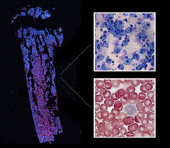  Aus hämatopoetische Stammzellen im Knochenmark (links) entwickeln sich eine Vielzahl von Blutzelltypen. Dazu gehören weisse Blutkörperchen wie T-Zellen und dendritische Zellen, die für unsere Immunabwehr verantwortlich sind (oben rechts) aber auch die roten Blutkörperchen, die für den Sauerstofftransport zuständig sind (unten rechts).