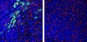 Fluoreszenzmikroskopie humaner Lungenepithelzellen nach SARS-CoV-2 Infektion 