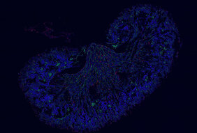 Makrophagen (rot) in der Niere einer neugeborenen Maus (das Nierengewebe ist blau dargestellt, Blutgefäße in der Niere gelb).