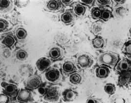 Transmissionselektronenmikroskopische Aufnahme von Virionen eines Herpes-Simplex-Virus