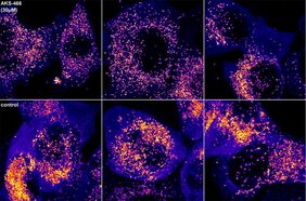 Corona Fluoxetin-ähnlichen Molekül