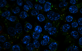 menschliche Zellen mit einer krankheitsauslösenden RBM20-Mutante