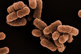 Elektronenmikroskopische Aufnahme von Klebsiella oxytoca