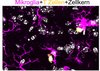 Mikroglia (magenta) - interagieren mit T Zellen (gelb) im zentralen Nervensystem von SPG15-defizienten Mäusen.