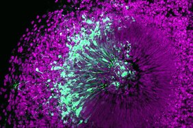 Mikroskopische Aufnahme eines menschlichen Gehirn-Organoids 