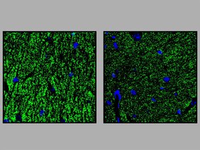 Hippocampus: In den transgenen Mäusen (Pigv341E; rechts) ist eine geringere Anzahl von Vesikeln (grün) vorhanden, in denen Neurotransmitter gespeichert sind als bei den Kontrolltieren