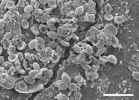 rasterelektronenmikroskopische Aufnahme von Pilzsporen entlang eines Risses in einem Mikroplastik-Partikel. 