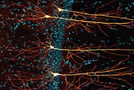 Die Neurone im Hippocampus transgener Mäuse konnten durch die Behandlung mit Nitarsone erhalten werden 