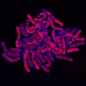 Die Mikroskopieaufnahme zeigt die DNA in Blau und die replizierten Bereiche in Rot. 