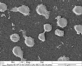 Aufnahme mit einem Elektronenmikroskop von T-Zellen auf einer nanoporösen Oberfläche. Aufnahme mit einem Elektronenmikroskop von T-Zellen auf einer nanoporösen Oberfläche.