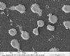 Aufnahme mit einem Elektronenmikroskop von T-Zellen auf einer nanoporösen Oberfläche. Aufnahme mit einem Elektronenmikroskop von T-Zellen auf einer nanoporösen Oberfläche.