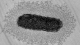 Transmissionselektronenmikroskopische Aufnahme einer Zelle einer zunehmend virulenten Subpopulation von Klebsiella pneumoniae Transmissionselektronenmikroskopische Aufnahme einer Zelle einer zunehmend virulenten Subpopulation von Klebsiella pneumoniae