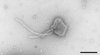 Respiratorisches Synzytial-Virus (Respiratory syncytial virus, RSV), ein Pneumovirus aus der Familie der Paramyxoviren. Das Bild zeigt ein einzelnes Viruspartikel