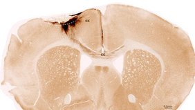 Koronaler Schnitt durch das Gehirn einer Maus nach einem Schlaganfall und der Transplantation neuronaler Stammzellen 