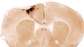 Koronaler Schnitt durch das Gehirn einer Maus nach einem Schlaganfall und der Transplantation neuronaler Stammzellen 
