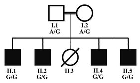 Stammbaum der Familie mit vier betroffenen Söhnen, die von Vater und Mutter die Mutation geerbt haben. Die Eltern zeigen jeweils eine defekte (G) und eine wild-typische (A) Genkopie.  
