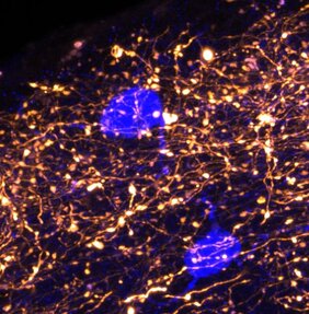 In der äußersten Schicht des Neokortex werden Informationen über das Gedächtnis durch Synapsen aus dem Thalamus (orange) empfangen