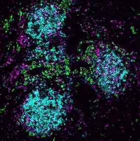 Ansammlungen von Immunzellen in einer Influenza-infizierten Lunge einer Maus. B-Zellen sind in Cyan dargestellt, T-Zellen in Magenta, und grüne Bereiche kennzeichnen Regionen mit niedrigem Sauerstoffgehalt. 