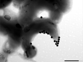 Giftigkeit von Mikro- und Nanoplastik