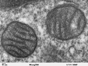 TEM-Bild Mitochondirum