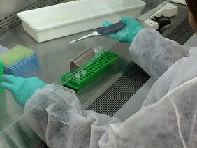 Ausschnitt arbeiten im Labor: Pipettieren unter einem Abzu