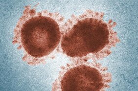 Coronaviren können gefährliche Infektionskrankheiten auslösen wie aktuell COVID-19. 