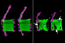 Links zwei gesunde Wirbelkörper aus der Wirbelsäule eines Medaka-Fisches: Die Knochenmatrix (grün) ist normal mineralisiert und von knochenbildenden Zellen (magenta) umgeben. Rechts die Situation bei einem osteoporotischen Fisch