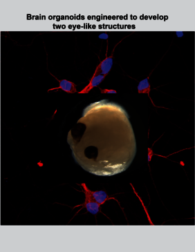 Hirnorganoid aus Stammzellen