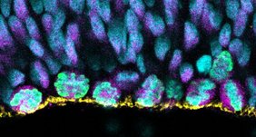 Sich teilende apikale Vorläuferzellen in einem Weißbüschelaffen-Gehirnorganoid. Grün, sich teilende Zellen; magenta, Vorläuferzellen; blau, Zellkerne; gelb, Oberfläche des Ventrikels. 