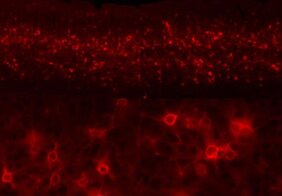 Neuronale Plastizität