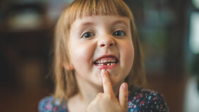 Notch-Signalweges Mutationen Zahnschmelz 