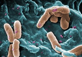 Pseudomonas aeruginosa (gelb) im Raster-Scanning-Mikroskop (nachgefärbt)