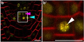 Lokalisation des PLETHORA3-Proteins 