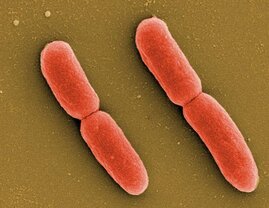 E. coli-Bakterien 